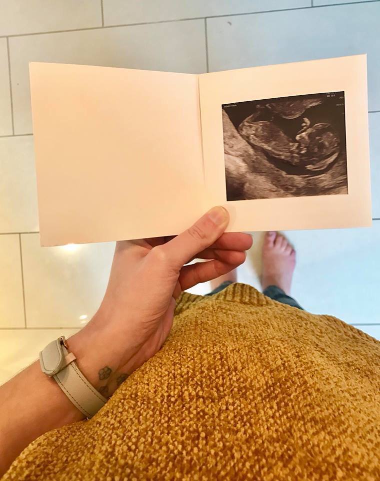 Miscarriage anxiety – the first trimester